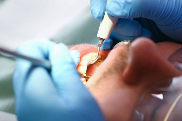 Best Emergency Treatment for Jaw Pain or Injury in Poseyville, IN