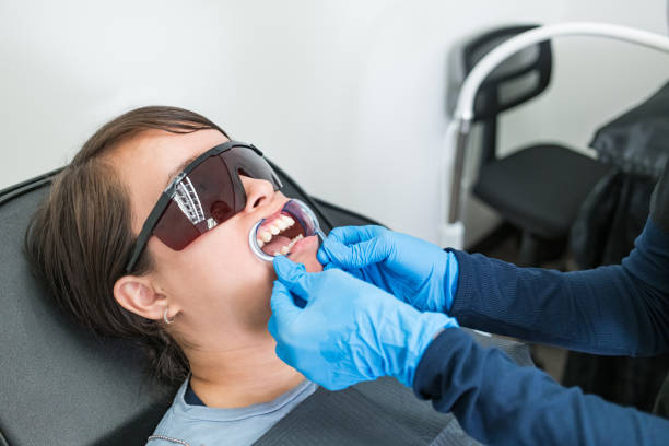 Best Knocked-Out Tooth (Avulsed Tooth) Treatment in Poseyville, IN